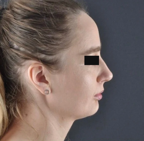 Before treatment, case 01