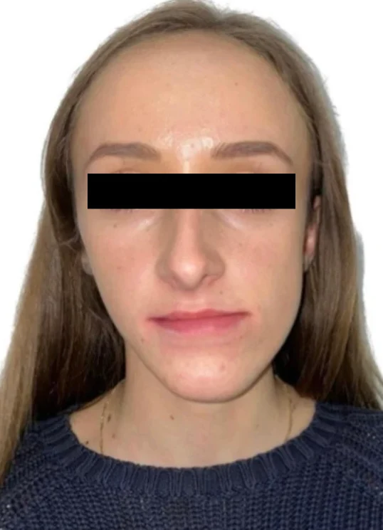 Before treatment, case 02