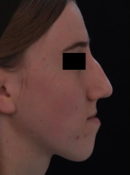 Before treatment, case 05