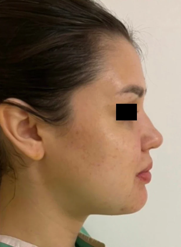 After treatment, case 07