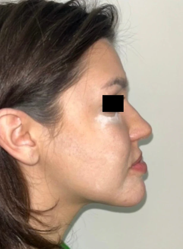 Before treatment, case 07