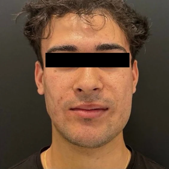 After treatment, case 04