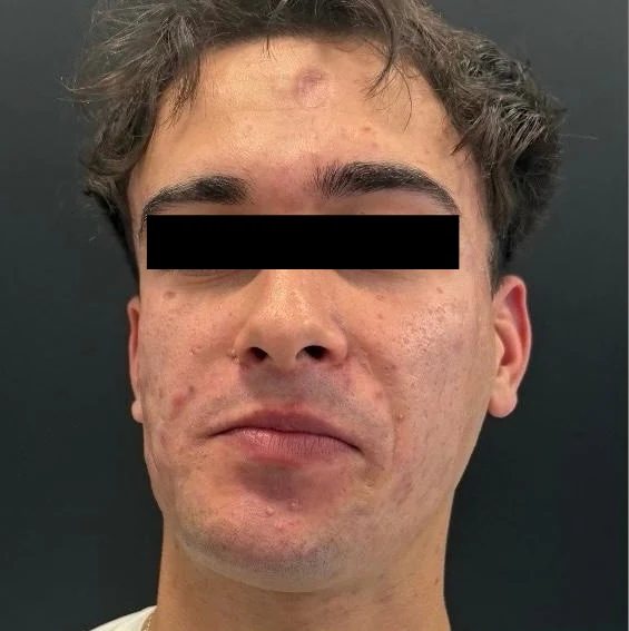 Before treatment, case 04